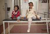 Les deux cousines Erada (à droite) et Hala (à gauche) ont été victimes d'une attaque aérienne. Ici, elles sont soignées au centre de réhabilitation de Sanaa.