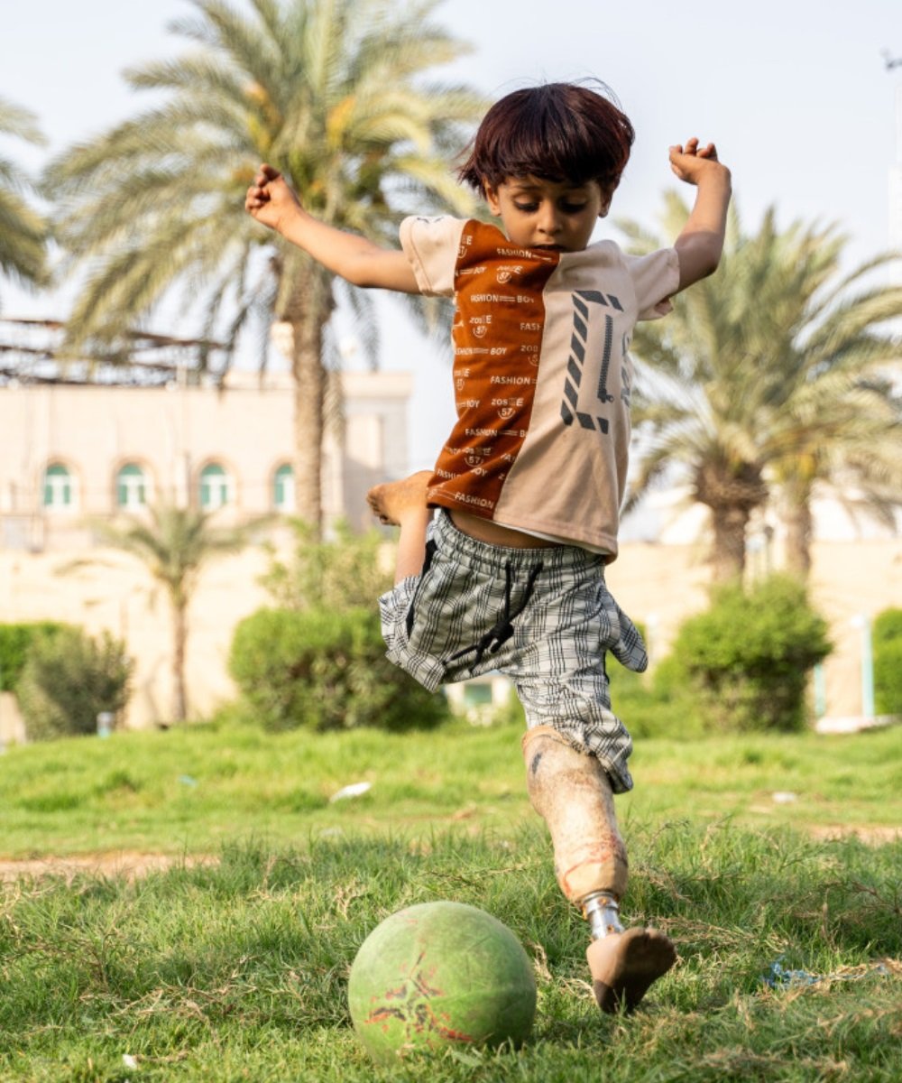 Ein Kind mit einer Prothese spielt Fussball