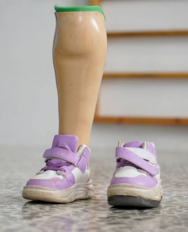 Eine Kinderprothese
