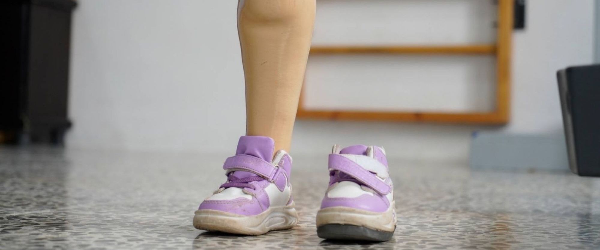 Eine Kinderprothese