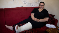 Nada Baghdadi, 27, hat einen Beinbruch, der durch die Explosion im Hafen von Beirut am 4. August verursacht wurde.