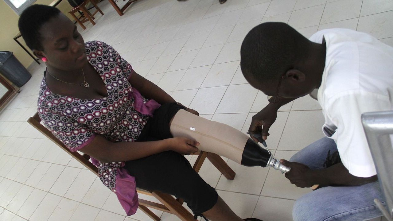 Une bénéficiaire de l'étude recevant sa prothèse 3D personnalisée, Togo