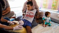 Abdel, victime civile d'un bombardement à Mossoul a dû être amputé de la jambe