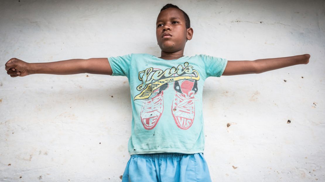 Jemerson, 13 Jahre, Minenopfer in Kolumbien