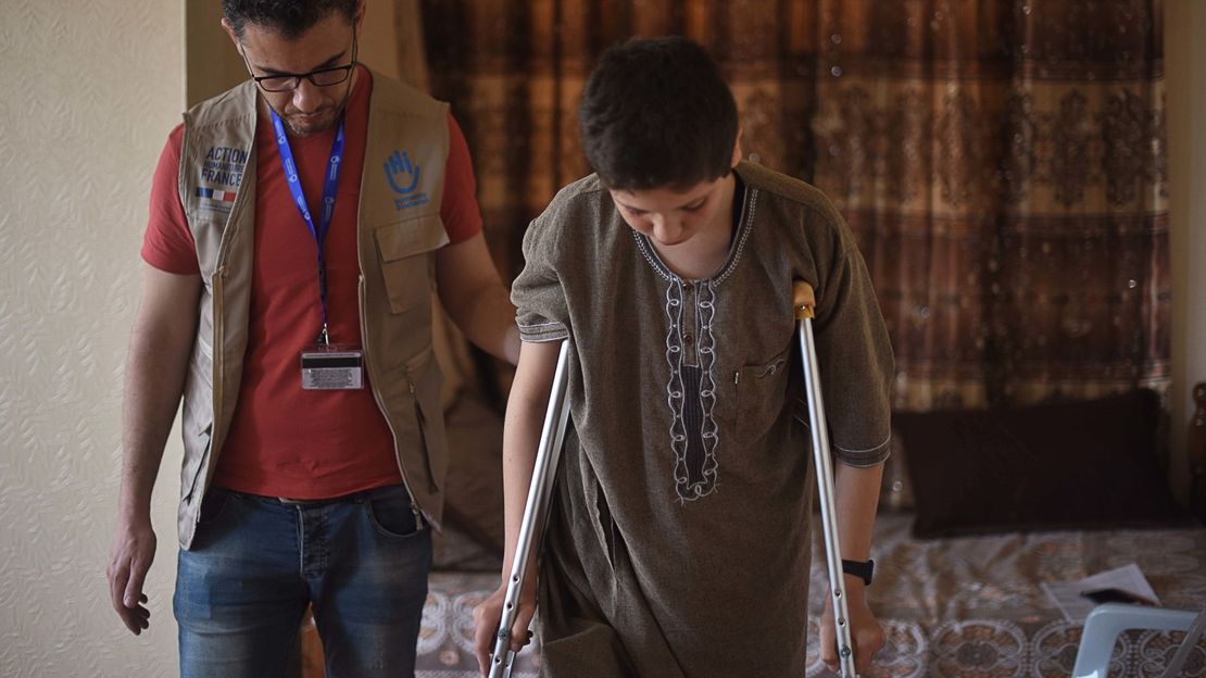 Ein Geschoss verletzte den 15-jährigen Ahmad an seinem rechten Bein.
