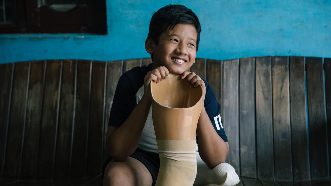 Nishan, 13 ans, vit à l'est du Népal (près de Biratnagar). Il a dû être amputé suite à un grave accident avec un tracteur quand il avait 5 ans. 