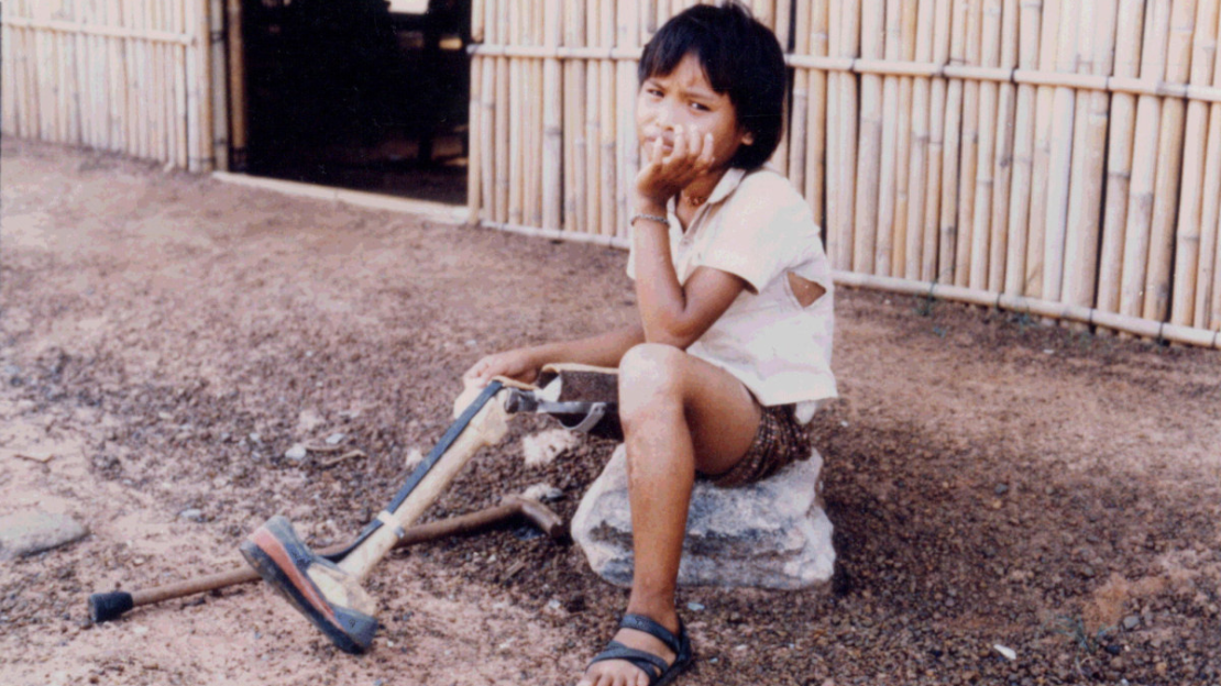 Foto eines sitzenden Mädchens, das eine Prothese trägt