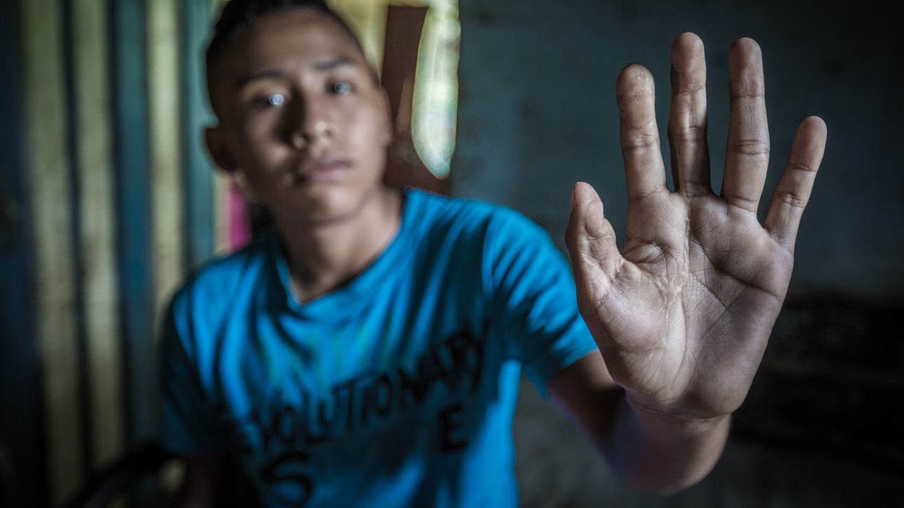 Colombie. Arlenson, 14 ans, victime d'un accident avec un engin explosif en 2011
