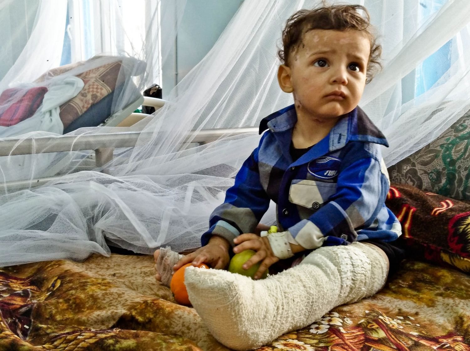 Photo de Ali, jeune garçon grièvement blessé.