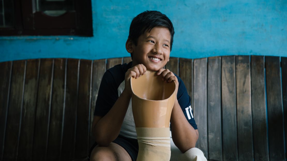 Nishan, 13 ans, vit à l'est du Népal (près de Biratnagar). Il a dû être amputé suite à un grave accident quand il avait 5 ans.
