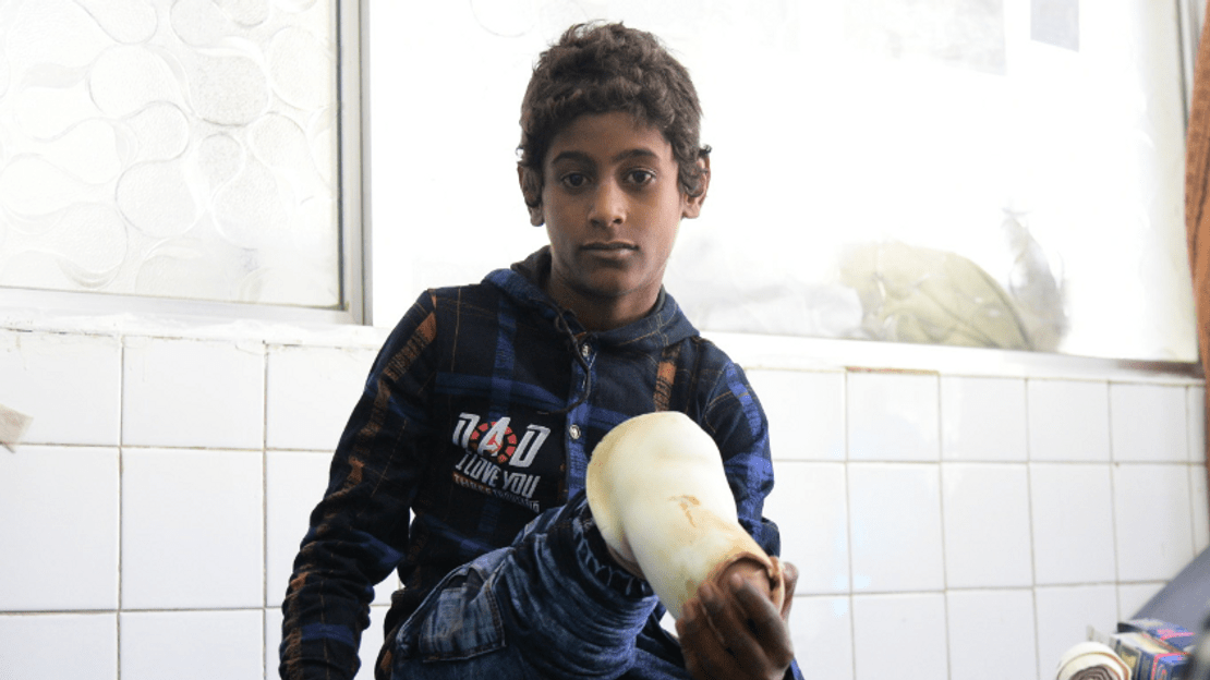 Abdullah au centre de physiothérapie et de prothèses de Sana’a