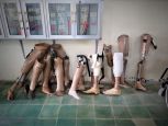 Les appareillages (ici des prothèses) anciens et cassés de différentes tailles disposés contre un mur du centre de réhabilitation de Kampong Cham